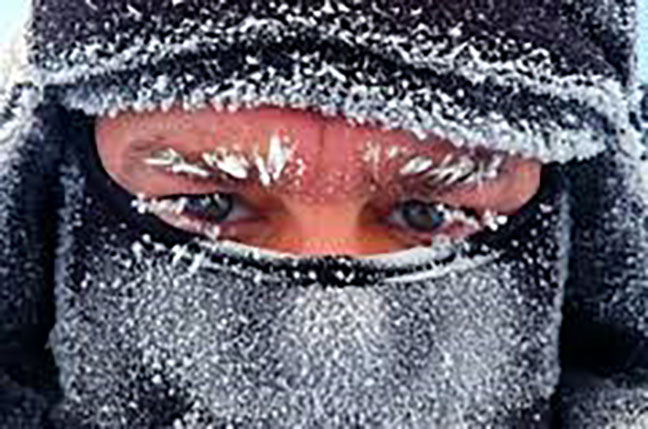 Frostbite